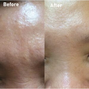 pmt-clinic-truoc-sau-16