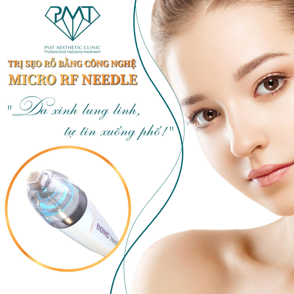 TRỊ SẸO RỖ RF NEEDLE