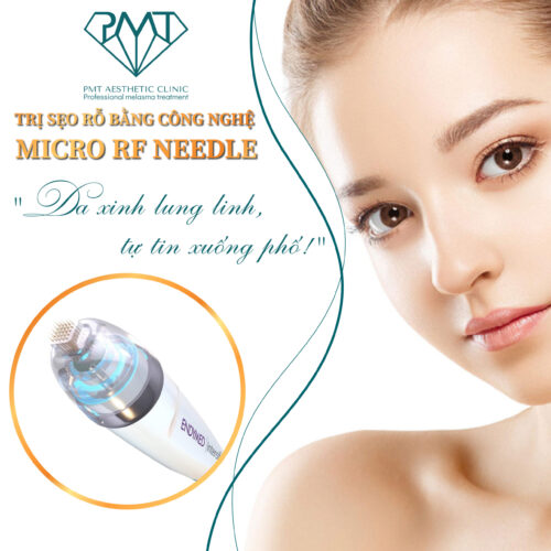 TRỊ SẸO RỖ RF NEEDLE