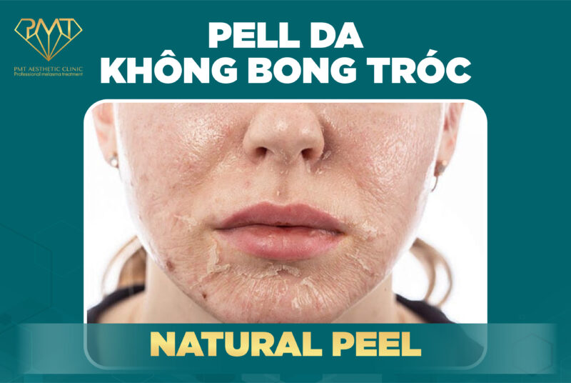 Natural Peel - PEEL DA KHÔNG BONG TRÓC