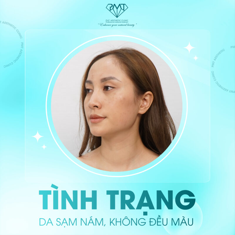 PMT Signature Clinic: Định nghĩa mới cho phòng khám trị nám tại Việt Nam