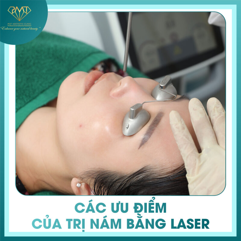 PMT Signature Clinic – Địa Chỉ Điều Trị Nám Hiện Đại và Hiệu Quả