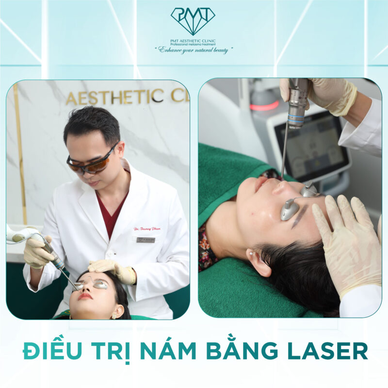Trị Nám Khó Với Công Nghệ Lavieen Thulium Laser 1927nm tại PMT Signature