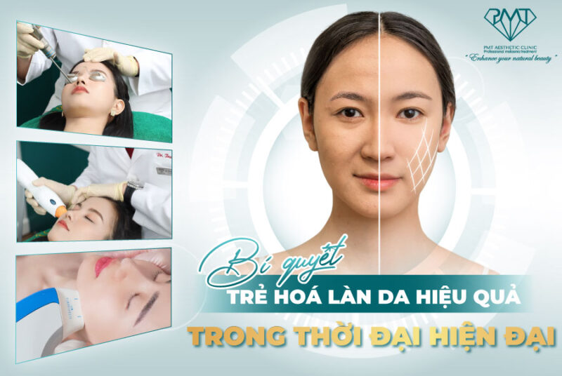 Đột Phá Công Nghệ Nâng Cơ MFACE
